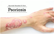 AROGYAM PURE HERBS KIT FOR PSORIASIS