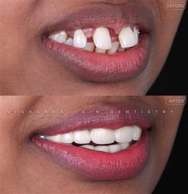 Dentist in Indore – Professional & Trusted Dental Care