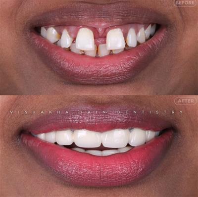 Dentist in Indore – Professional & Trusted Dental Care