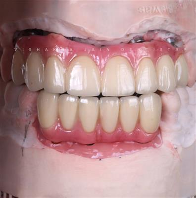 Dentist in Indore – Professional & Trusted Dental Care