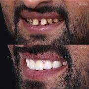 Dentist in Indore – Professional & Trusted Dental Care