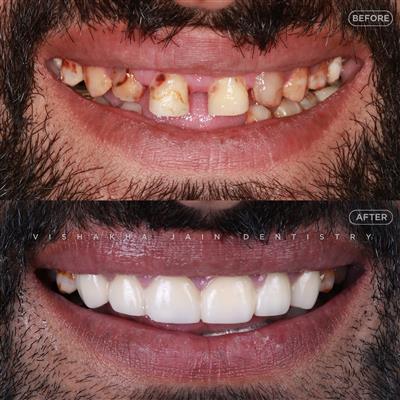 Dentist in Indore – Professional & Trusted Dental Care