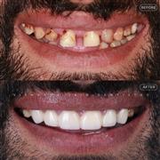 Dentist in Indore – Professional & Trusted Dental Care