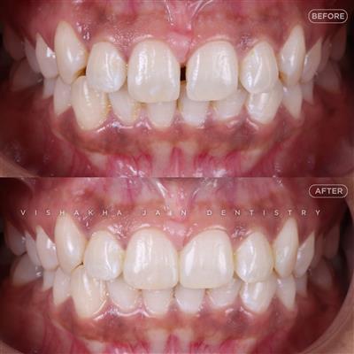 Dentist in Indore – Professional & Trusted Dental Care