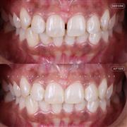 Dentist in Indore – Professional & Trusted Dental Care