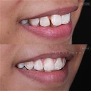 Dentist in Indore – Professional & Trusted Dental Care