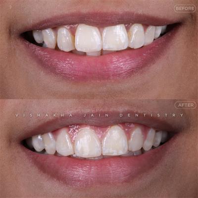 Dentist in Indore – Professional & Trusted Dental Care