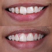 Dentist in Indore – Professional & Trusted Dental Care