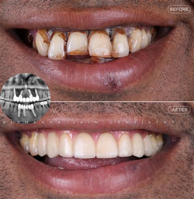 Dentist in Indore – Professional & Trusted Dental Care