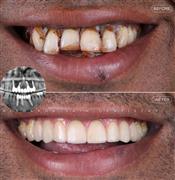 Dentist in Indore – Professional & Trusted Dental Care