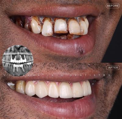 Dentist in Indore – Professional & Trusted Dental Care