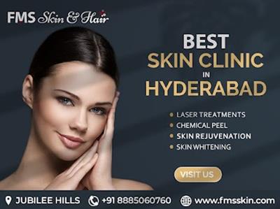 Best Skin Clinic in Hyderabad - FMS Skin & Hair Clinic