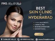 Best Skin Clinic in Hyderabad - FMS Skin & Hair Clinic