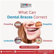 Best Braces Specialist in Gurgaon
