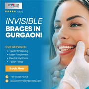 Get Invisible Braces in Gurgaon