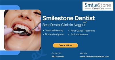 Smilestone Dentist - Best Dental Clinic in Nagpur