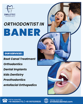 Beautiful Smiles Start Here – Expert Orthodontist in Baner