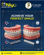 Transform Your Smile with Expert Braces Treatment at Niyo Dental Care!  Are you