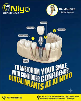 Restore Your Missing Teeth with Painless Dental Implants at Niyo Dental Care Ar