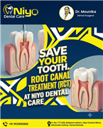 Pain-Free Root Canal Treatment (RCT) at Niyo Dental Care, Hanamkonda & Warangal