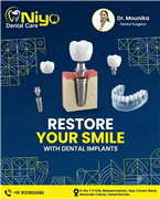 Restore Your Natural Smile with Dental Implants at Niyo Dental Care, Hanamkonda
