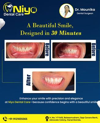 Transform Your Smile in Just 30 Minutes at Niyo Dental Care!  Are you searching