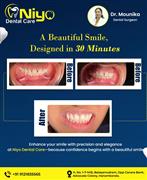 Transform Your Smile in Just 30 Minutes at Niyo Dental Care!  Are you searching