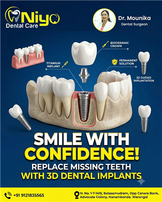 Top Dental Implants Treatment in Hanamkonda & Warangal | Niyo Dental Care