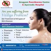 AROGYAM PURE HERBS KIT FOR VITILIGO