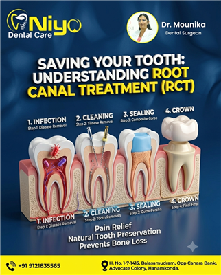 Say Goodbye to Toothache: Advanced Root Canal Treatment (RCT) at Niyo Dental Car
