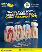 Say Goodbye to Toothache: Advanced Root Canal Treatment (RCT) at Niyo Dental Car