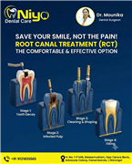 Save Your Natural Tooth with Painless Root Canal Treatment (RCT) at Niyo Dental