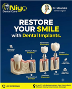Permanent Dental Implants at Niyo Dental Care, Hanamkonda | Warangal