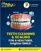 Best Dental Clinic in Warangal for Professional Teeth Cleaning & Scaling