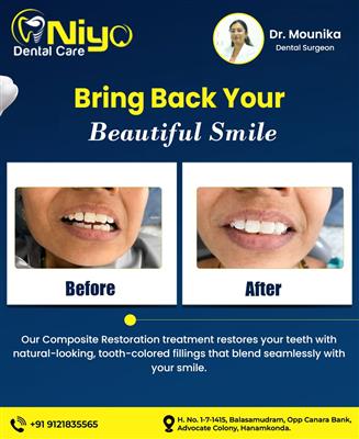 Fix a Chipped or Broken Tooth in Just 30 Minutes at Niyo Dental Care! 🦷✨