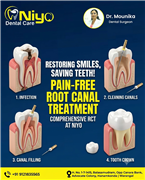 Best Dental Clinic in Hanamkonda for root canal treatment
