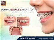 Dental Clinic for Braces in Langar House for Perfect Smile Correction