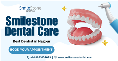 Smilestone Dental Clinic | Best Dentist in Nagpur