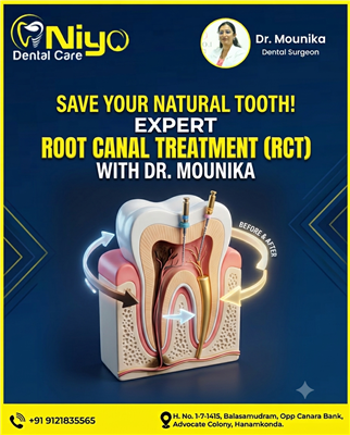 Painless Root Canal Treatment (RCT) at Niyo Dental Care, Hanamkonda & Warangal