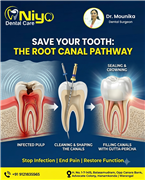 Looking for painless Root Canal Treatment (RCT) near you?   Niyo Dental Care is
