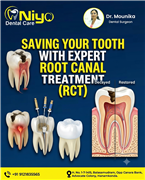 Save Your Natural Tooth with Advanced Root Canal Treatment in Hanamkonda & Waran