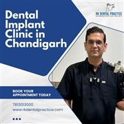 Dental Implants Near You for Permanent Tooth Replacement