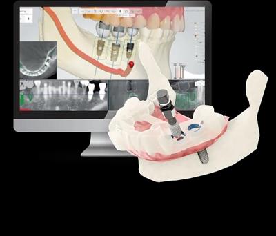 Dental Surgery Instruments & Surgical Kits | DIO Implant India