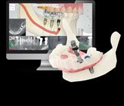 Dental Surgery Instruments & Surgical Kits | DIO Implant India
