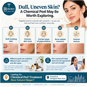 Chemical Peel Treatment in Pune - Skin Peel Treatment