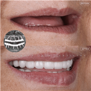 Best Dental Clinic in Indore | Dental Implants & Smile Designing