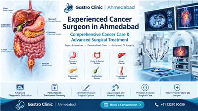 Experienced Cancer Surgeon in Ahmedabad – Comprehensive Cancer Care